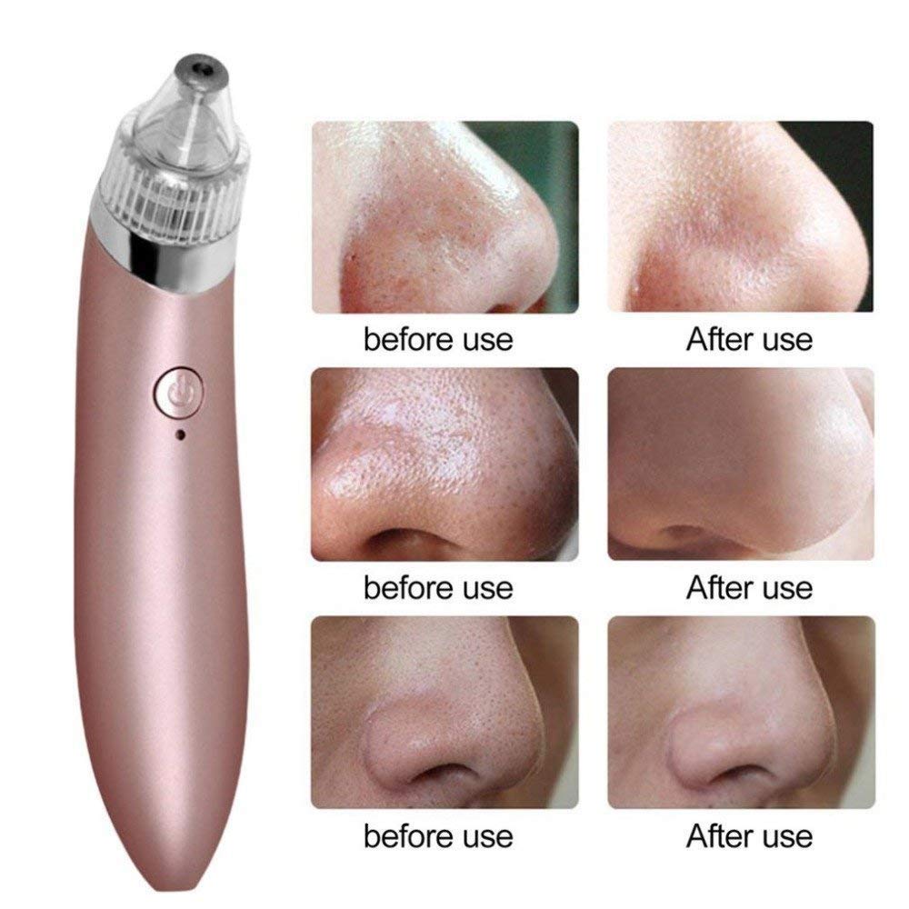 Vacuum Pore Cleaner