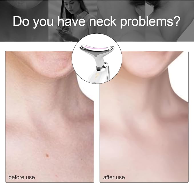 Neck and face wrinkle remover